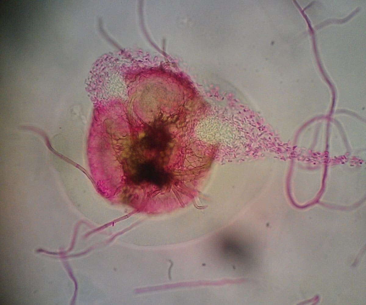 phoma pycnidia and conidia