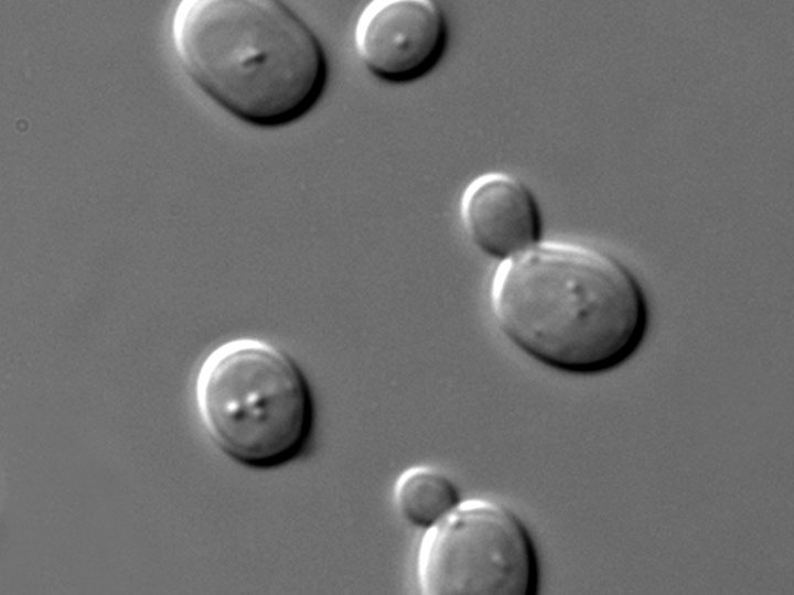 Yeast cells under a microscope, with small buds forming on the parent cells